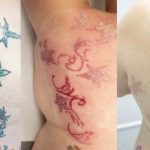 Laser – The New Technology For Tattoo Deletion!