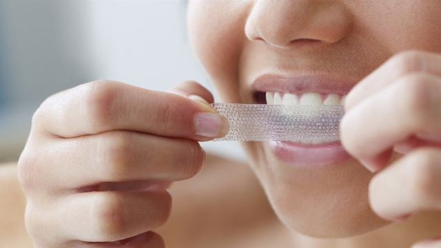 10 Secrets to a Stunning Smile with Crest Whitening Strips